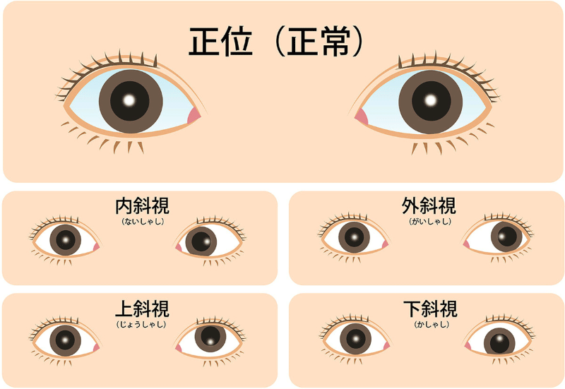 【人気視力回復トレーニング】アイトレーナー さらに値下げしました】視力回復トレーニングアイトレーナー